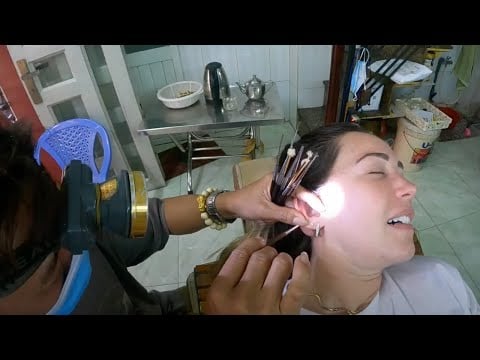 Limpieza extrema de oídos en Vietnam👂🏻🇻🇳 *Solo 0,75 dólares*