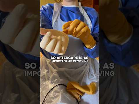 Removing gloves after a procedure is really important. #medicalexam #surgicalgloves #latexgloves
