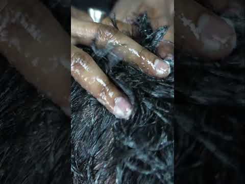 Closeup ASMR Oily Head Scratching #shorts