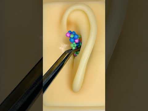 ASMR Deep Earwax Removal (Ear Cleaning) #asmr #asmrshorts #youtubeshorts #shorts