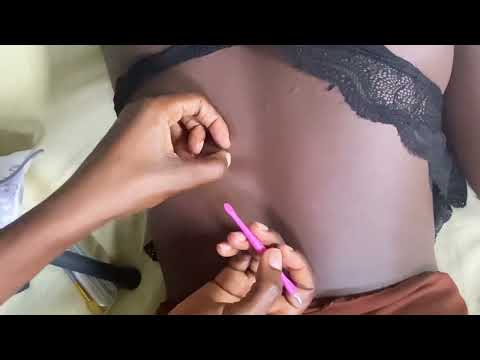 ASMR NITPICKING MY SISTERS BACK WITH BUBBLEGUM