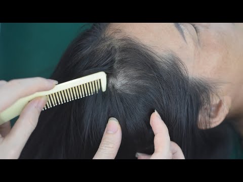 ASMR Scalp Scratch No Talking, Nape & Hair Parting On Real Person For Relaxation