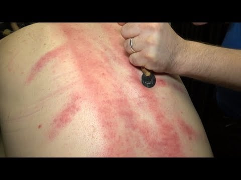 ALMOST CRIED AS HE SCALPING HIS BACK 💈 SHAVE 💈 CRACKS 💈 ASMR head,face,arm,foot,chest,back massage