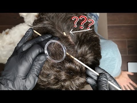 Real Person ASMR Lice Check and Scalp Inspection 7.1 No Talking