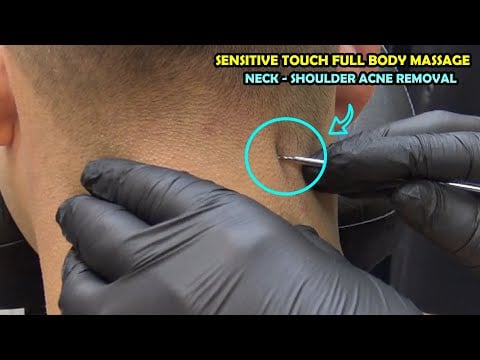 💈 I ACNE REMOVAL FROM HIS NECK & SHOULDER + CRACKS + head,face,ear,chest,belly,armpit,back massage