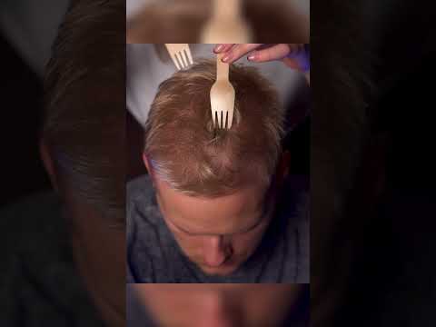 Scalp Scratch ASMR That Hits the Spot 🎯💤