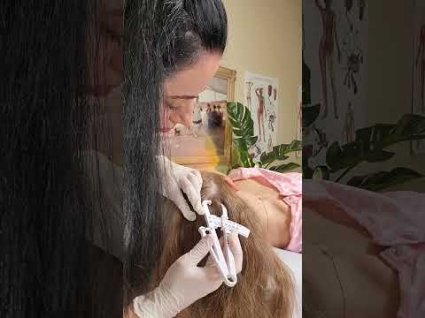 ASMR Real Person Scalp & Haor Touching (Soft Spoken Medical Exam) Unintentional ASMR Roleplay