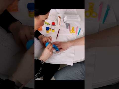 Hand skin & allergy check