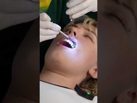 Daily Short(Sorry for Messed up Audio!) Dental Exam  #asmr  #asmrmedical #asmrdentist #asmrteeth