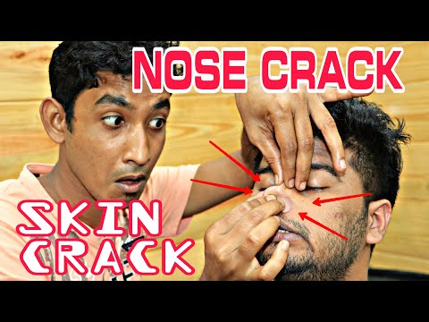 First Time Nose Crack Experience | skin crack  lovely Head Massage By Master Of Skin Craking