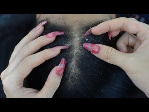 [ ASMR ] Dandruff Scratching, Scalp Scratching, Head Scratching With Long Nails For Relieve Stress