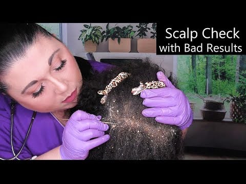 ASMR Scalp Check with Bad Results (Dandruff Removal, Scalp Treatment, Afro/Kinky Hair) Medical RP