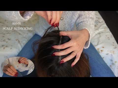 asmr scalp check - nitpicking and fast nail tapping - no talking
