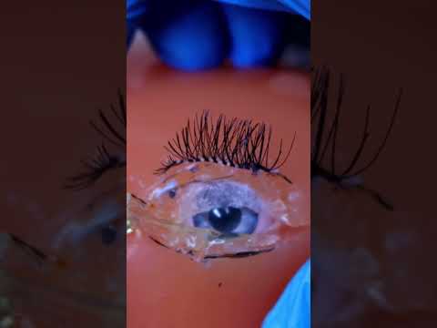 Cirurgia no olho - ASMR #shorts