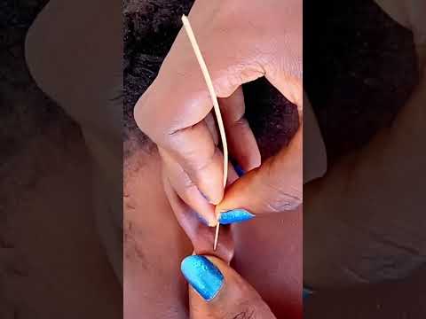 Asmr ✨A rare and attentive ear cleaning #asmr #satisfying #tingling #tinglyfeeling