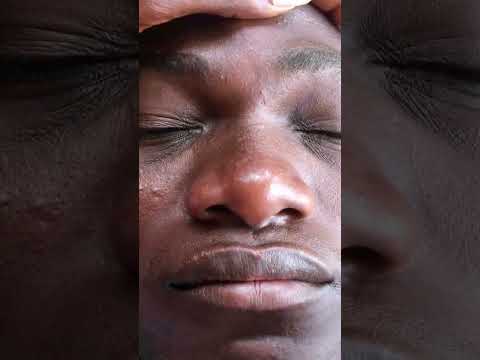 Eye brows nitpicking Asmr #satisfying #asmrscratching #asmr #headscratches #asmrsounds