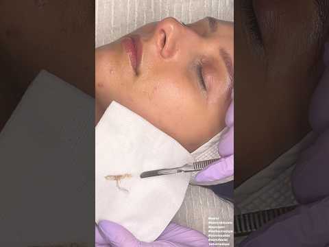 ASMR Dermaplaning Facial