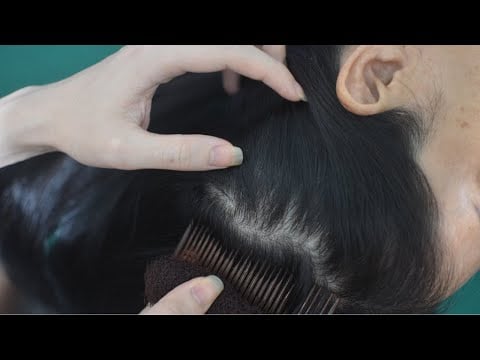 ASMR Nape And Scalp Scratching With Hair Parting, Relaxing Sounds For Anxiety Relief