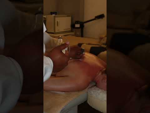 Fantástico cupping en espalda #masaje #spa #masajerelajante #relax #asmr #short