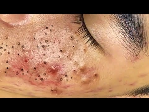 حلول طبيعية لبشرة صافية# 𝐒𝐤𝐢𝐧 𝐂𝐚𝐫𝐞 66891