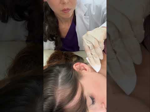 Asmr scalp tingles #asmr #asmrsounds #asmrvideo #relax #relaxing #satisfying #hair #sleep #tingles
