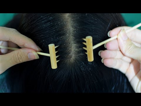 ASMR Relaxing Scalp Check For Sleep #dandruff #scratching #tools #wooden