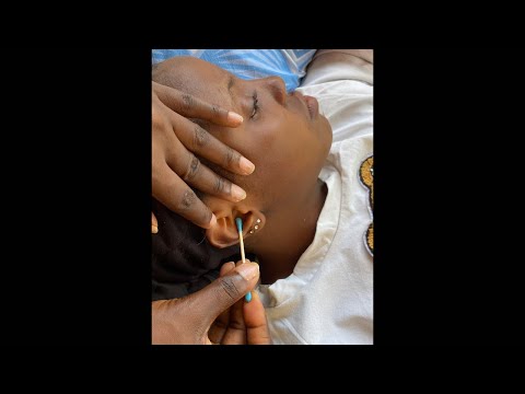 ASMR EAR CLEANING AND NITPICKING FOR SLEEP VERY TINGLING