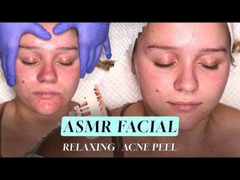 ASMR FACIAL | Relaxing Acne Peel