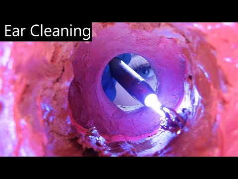 ASMR Ear Cleaning (Ear Exam, Otoscope, Ear Picking, Ear Scraping, Light Triggers) Medical Roleplay