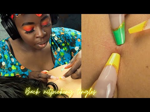 ASMR| Rare & Super Attentive BACK NITPICKING ~ sleep 😴