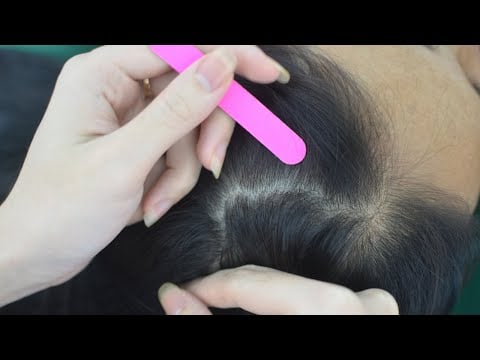 ASMR Aggressive Scratching Scalp Real Person, Relaxing Hair Play, Hair Parting For Stress Relief