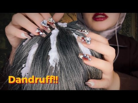 Ultimate ASMR Dandruff Removal & Scalp Massage | Relaxing Hair Scratching & Brushing 💆🏻‍♀️