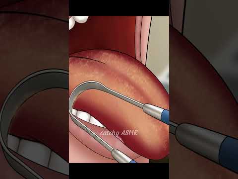 ASMR Tongue Cleaning, Relaxing Tongue scraper#asmr #animation #trending #satisfying