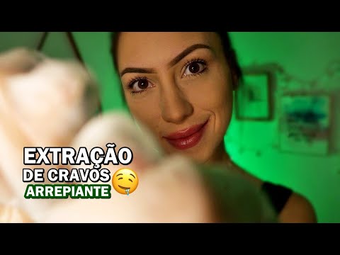 ASMR: EXTRAÇÃO DE CRAVOS SUPER ARREPIANTE PARA DORMIR