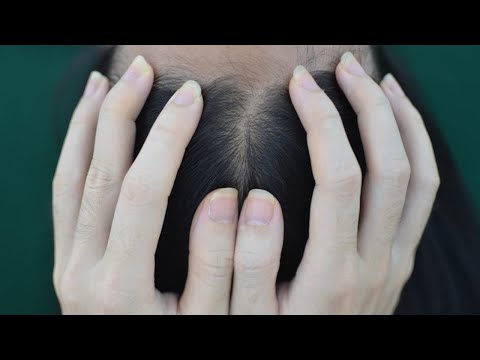 ASMR Hair Parting, Hair Brushing, Real Person Scalp Massage For Headache Relief ( Therapy Sounds )