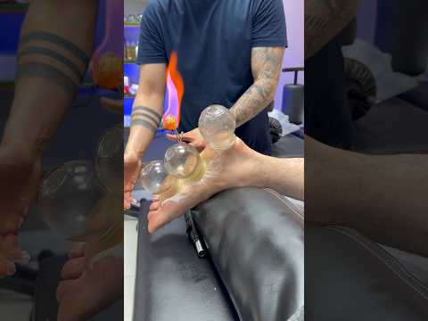 "asmr"vip cupping😍#shorts #cupping #asmr #explore #relaxing #trendingshorts #youtubeshorts #keşfet