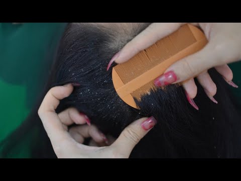 ASMR Scalp Scratching, Melting Scalp Massage, Hair Brushing, Hair Scratching For Relaxation