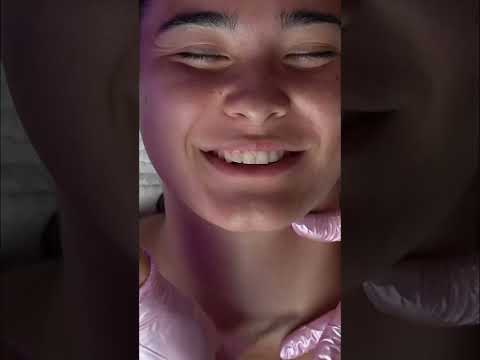 Satisfying Lip & Nose Facial Extraction ASMR #shorts