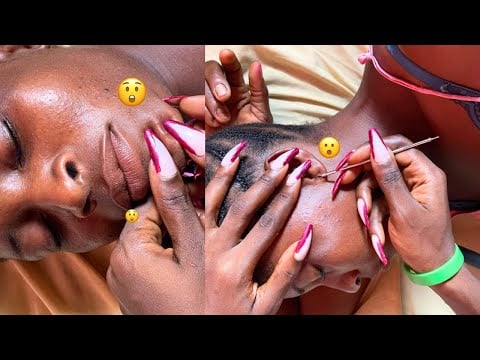 ASMR BEST SLEEP TRIGGER WITH GUM CRACKING