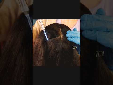 Don’t Blink… Hair Root Inspection 👀