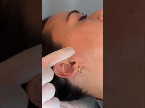 ASMR Ear Exam, Massage, Treatment 🩵 #asmr #asmrrealperson #asmrear #asmrmedical #asmrsounds