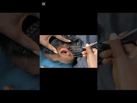 Relaxing ear cleaning and nitpicking head scratching for sleep very satisfying #asmrearcleaning
