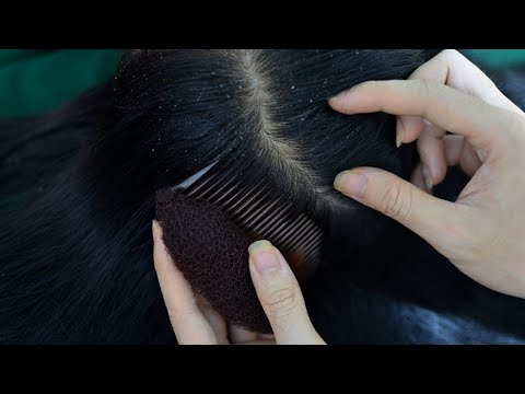 ASMR Head Scratching No Talking, Head Massage For Deep Sleep ( No Talking )