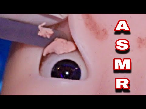 ASMR | CIRURGIA NO OLHO - REMOÇÃO SATISFATÓRIO