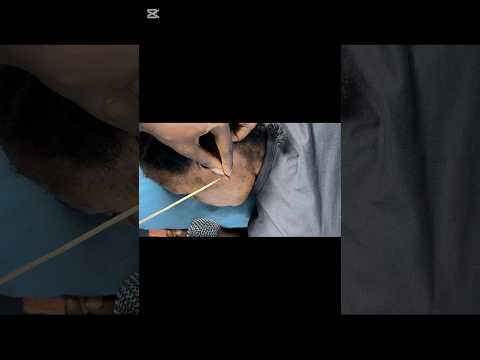Ear cleaning and ear scratching, scalp scratching for intense tingles sleep in minutes