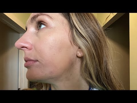ASMR VLOG - 1 month of accutane 