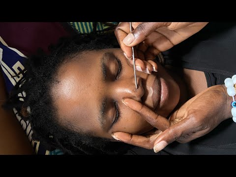 ASMR NITPICKING MY SISTER FACE @ asmrbybecserah