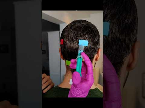 Treatment for annoying dandruff