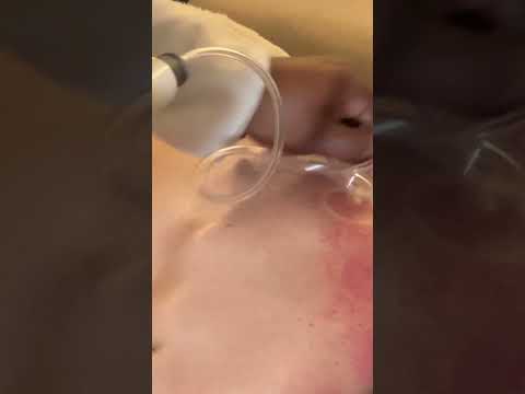 Me hice un masaje relajante que incluyó cupping en espalda🤩 #massage #relax #masaje #short #cupping