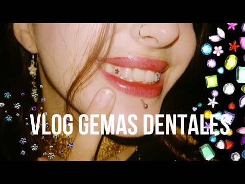 ASMR|| Acompáñame a ponerme Gemas Dentales🌟💎